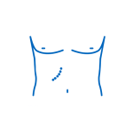 cirugia-abierta
