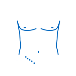 cirugia-abierta