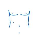 cirugia-laaroscopica
