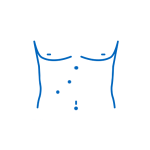 laparoscopica